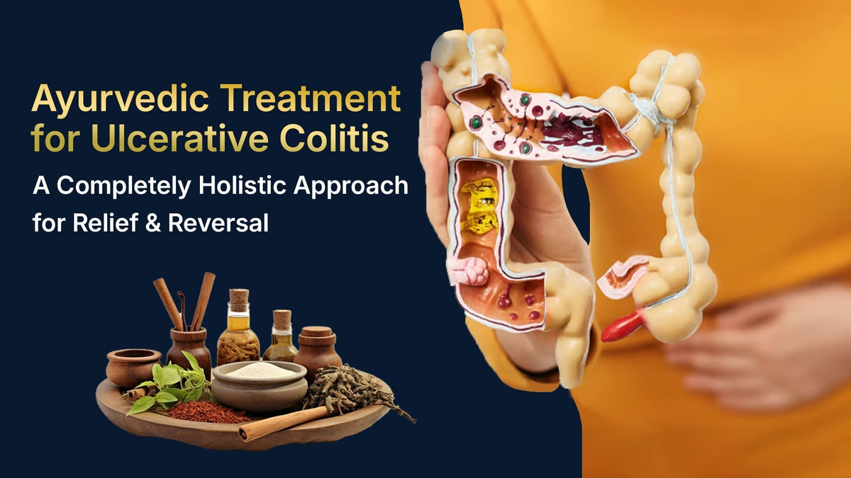 Ayurvedic Treatment for Ulcerative Colitis: A Completely Holistic Approach for Relief & Reversal