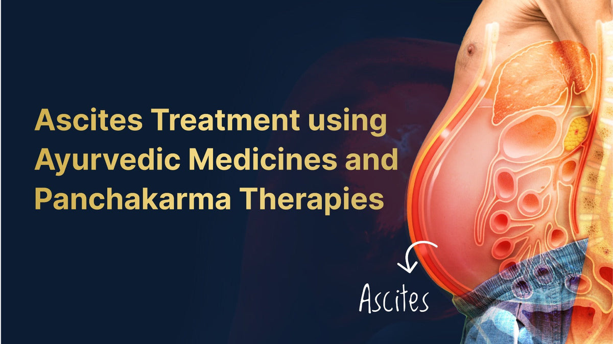 Ascites Treatment using Ayurvedic Medicines and Panchakarma Therapies