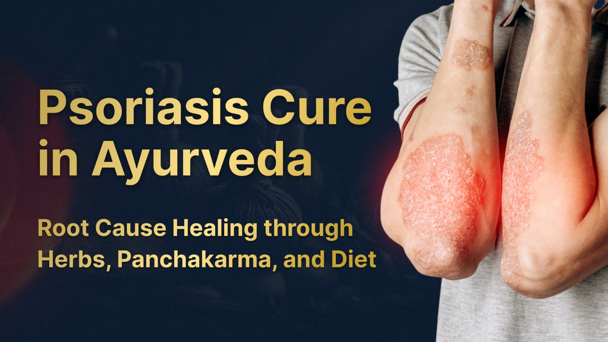 Psoriasis Cure in Ayurveda: Root Cause Healing through Herbs, Panchakarma, and Diet
