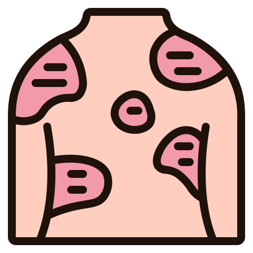 Psoriasis
