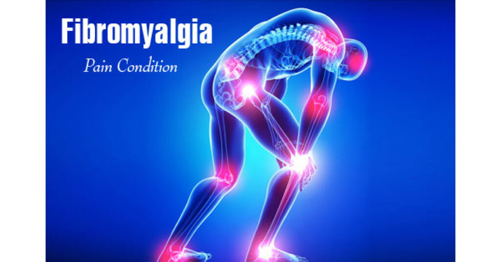 Fibromyalgia- A “Widespread Pain” Disorder
