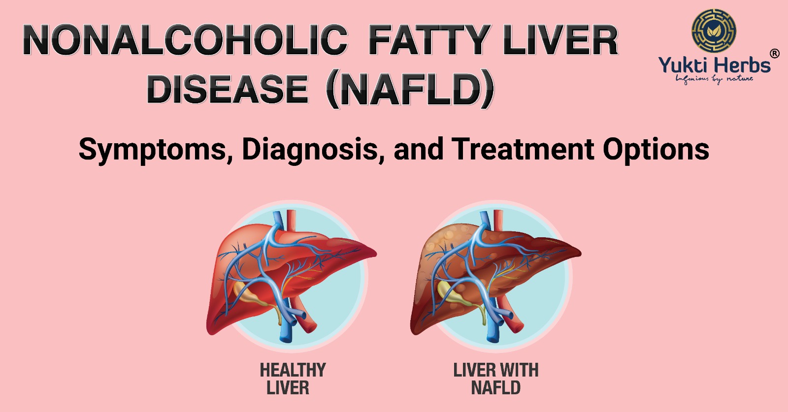 NAFLD Ayurvedic Treatment