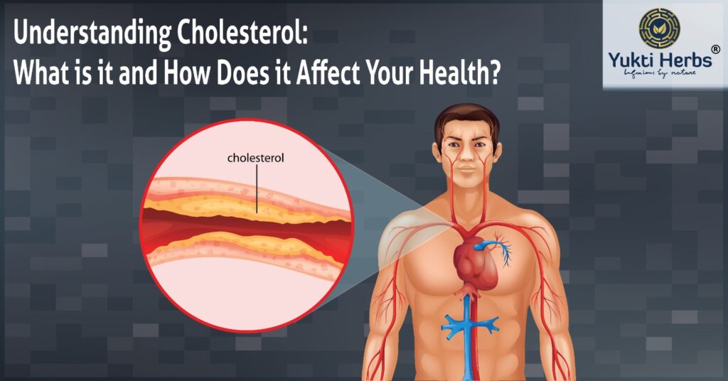 Cholesterol: What is it and How Does it Affect Your Health?
